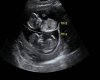 nai's   ultrasound