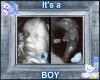 Baby boy ultrasound