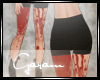 Bloody Legs~~!!