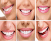 Teeth F