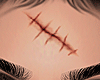 ◈ Wound.:
