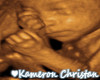 Kameron Sonogram