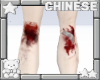 ᢉ𐭩 bloody knees
