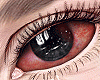 ❥ Bloodshot eyes