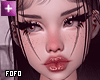 add+ freckles light
