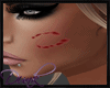 Q BiteMark Request