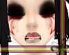 RHE // Bleeding