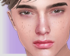 CONRAD Head