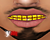 YM|Gold Grill