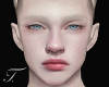 Albino