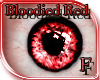 (E) Bloodied Red Eyes 2