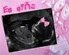 pregnant ( es nina)