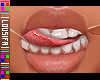  . MH Teeth 04