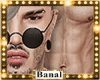 [B]=> Ranny Skin*