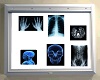 Screen with Xrays try b4