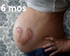 Baby Bump