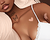 Vitiligo 04