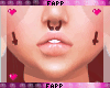 ▲ Inverted Dimples