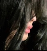 asiilh