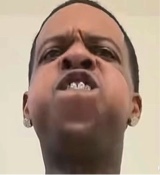 Guest_braceface684546