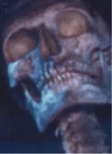 Guest_Mikeytheman2