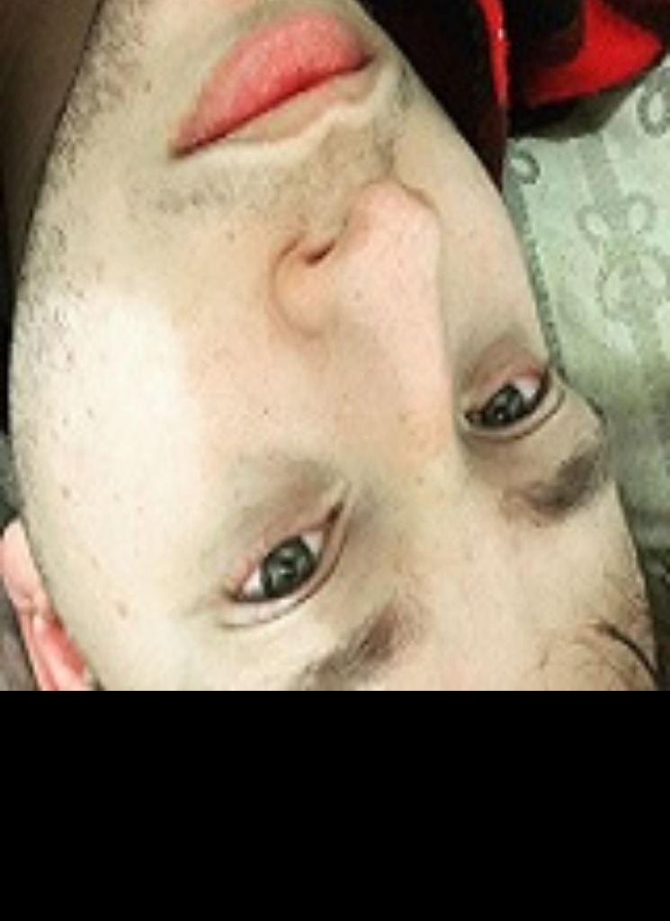 Awwkward
