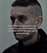 D3NTE