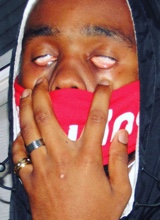 ThirdEyed