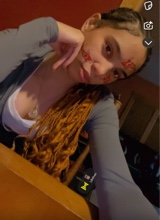 mya715200