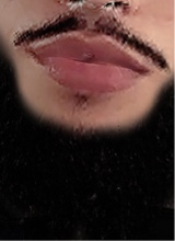 avpic