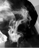 Guest_xah14
