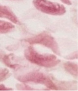 Guest_irisaestetical