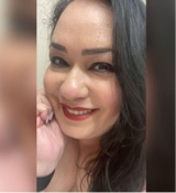 Alexa993329