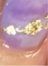Guest_gelsgerms1
