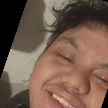 avpic