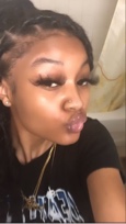 Mya215232